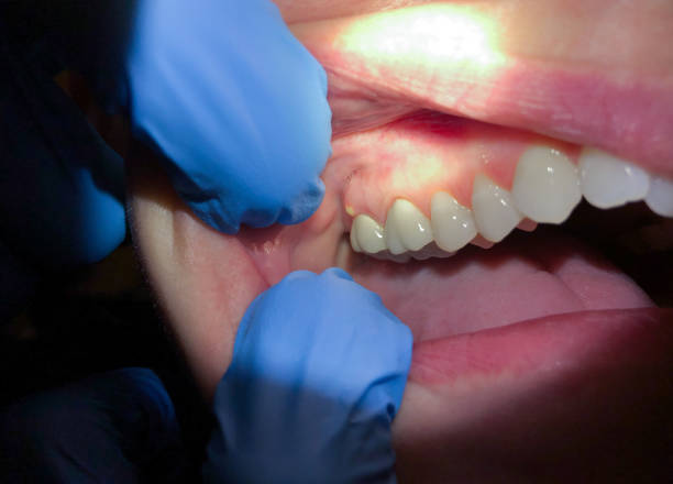 Best Pediatric Emergency Dentist in Brookfield, IL